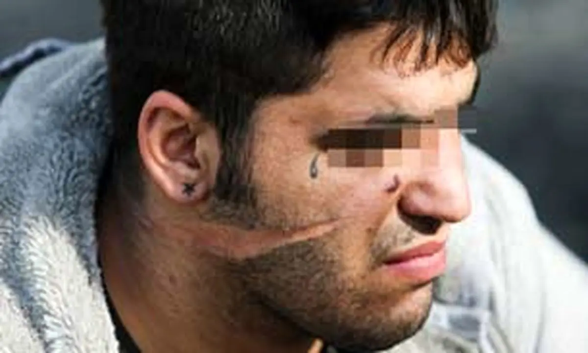 چاقو کشی بر روی مامور پلیس راهور