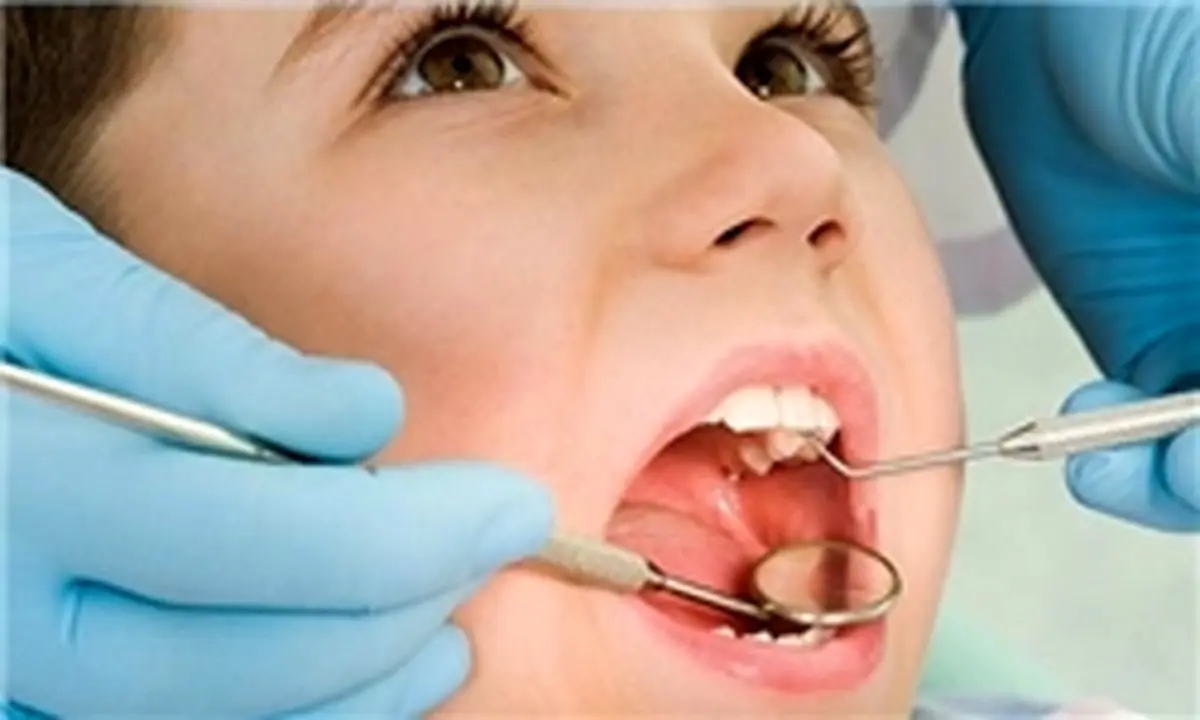 انجام معاینه دهان در سن 7 سالگی ضروری است