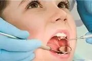انجام معاینه دهان در سن 7 سالگی ضروری است