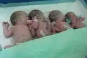 
چهار قلو زائی زن کاشمری در مشهد
