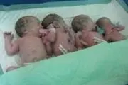 
چهار قلو زائی زن کاشمری در مشهد

