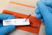 اینفوگرافیک| آنچه باید در مورد تست آنتی‌بادی کرونا بدانیم
