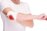 با علائم بیماری هموفیلی آشنا شوید؟ 