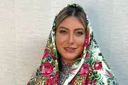 چهره جدید فریبا نادری پس از جراحی زیبایی
