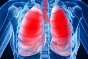 ۶ راهکار ساده برای تقویت ریه‌ها و دستگاه تنفسی