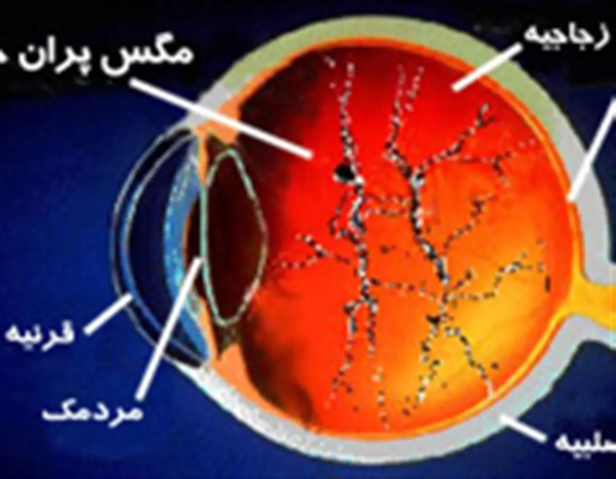 این علائم نشان دهنده بیماری چشم است