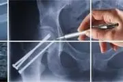 مهمترین علل شایع مرگ و میر بعد از ۴ سرطان