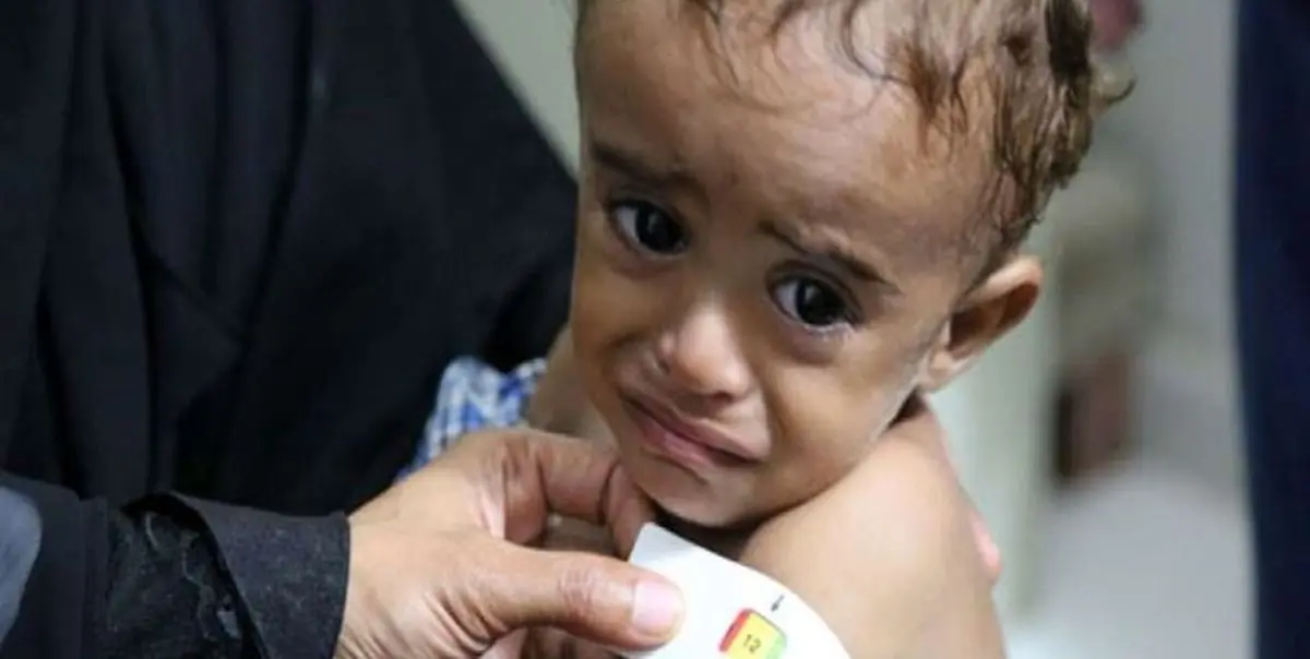 کمبود آهن بهره هوشی کودک را کاهش میدهد