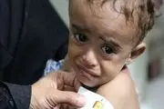 کمبود آهن بهره هوشی کودک را کاهش می‌دهد