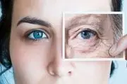 عوامل ایجاد گودی و سیاهی زیر چشم