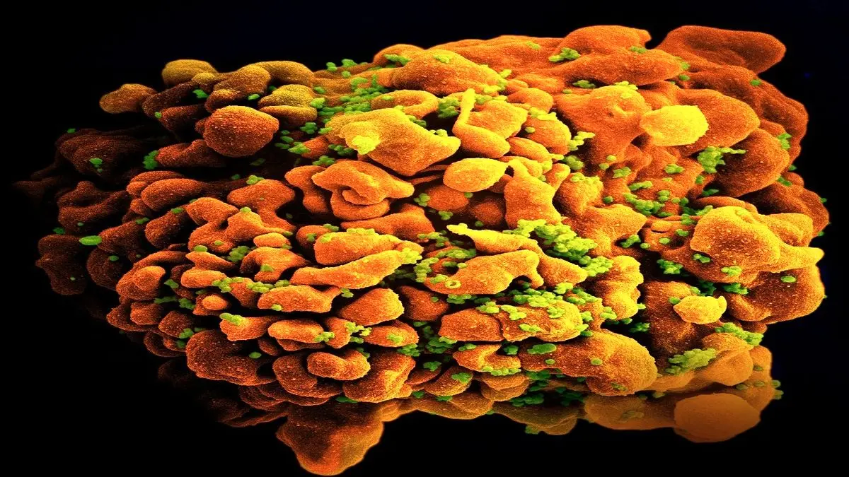 پیش بینی خطر سرطان مقعد در افراد مبتلا به عفونت HIV