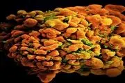 پیش بینی خطر سرطان مقعد در افراد مبتلا به عفونت HIV
