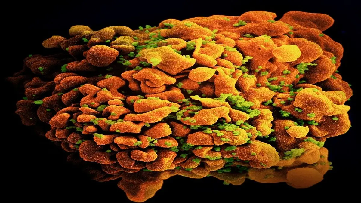 پیش بینی خطر سرطان مقعد در افراد مبتلا به عفونت HIV

