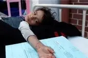 کشته شدن 2000 یمنی بر اثربیماری وبا