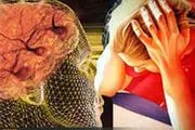 علل ابتلا به صرع