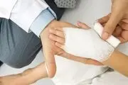 انواع سوختگی پوست و راه های درمان آن
