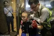
کشته و زخمی شدن نزدیک به 300 تن در درگیری‌های هنگ‌کنگ
