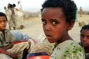 بیش از ۷ میلیون یمنی با سوء تغذیه مواجه هستند