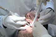 جرمگیری دندان راه مناسبی برای رفع بوی بددهان