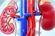 با یک کلیه می‌شود زندگی کرد؟