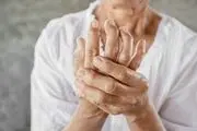 هرگز سراغ درمان خودسرانه تورم اندام‌ها نروید!