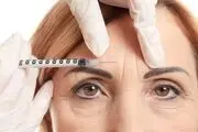 چگونه با بوتاکس به چهره ی رویایی خود برسیم؟
