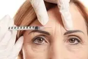 چگونه با بوتاکس به چهره ی رویایی خود برسیم؟
