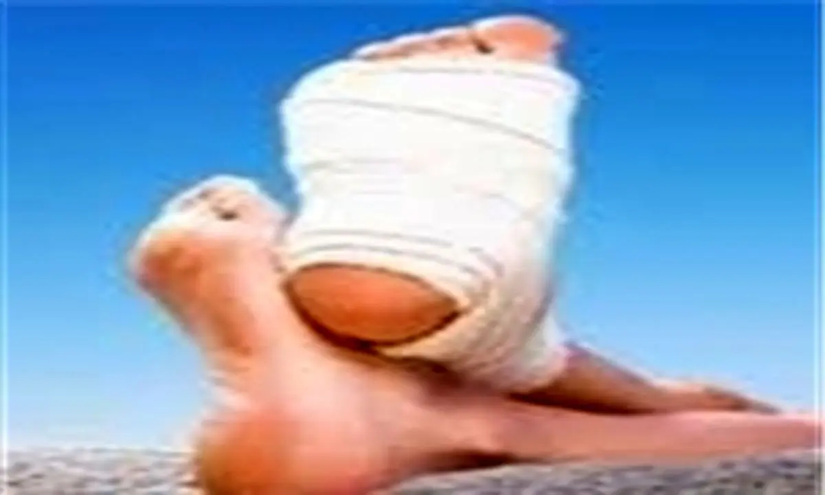 اولین اقدام اورژانسی هنگام پیچخوردگی مچ پا