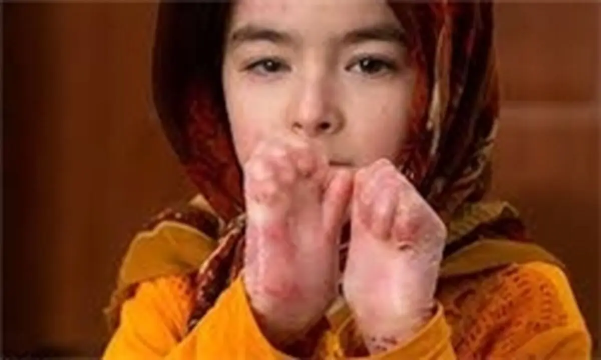 ازدواج فامیلی مهم ترین دلیل پروانه ای شدن