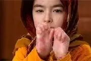 ازدواج فامیلی مهم ترین دلیل پروانه ای شدن