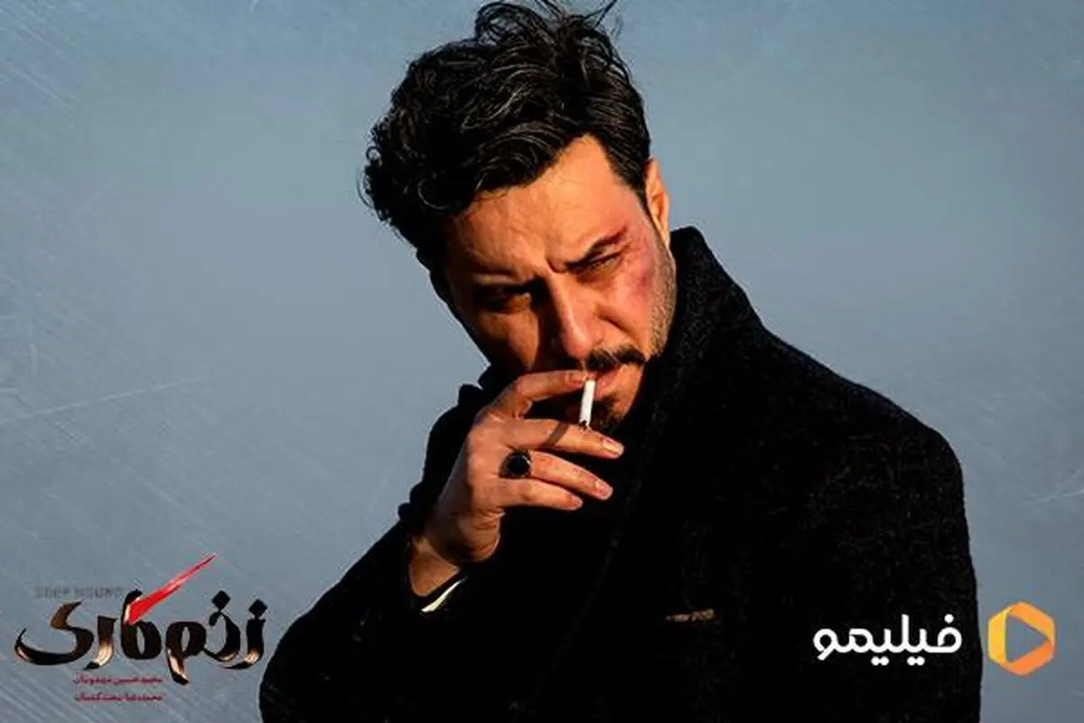 ۷۰ درصد «زخم کاری» فیلمبرداری شد/ آماده‌سازی برای پخش