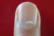 تغییر رنگ ناخن‌ها را جدی بگیرید