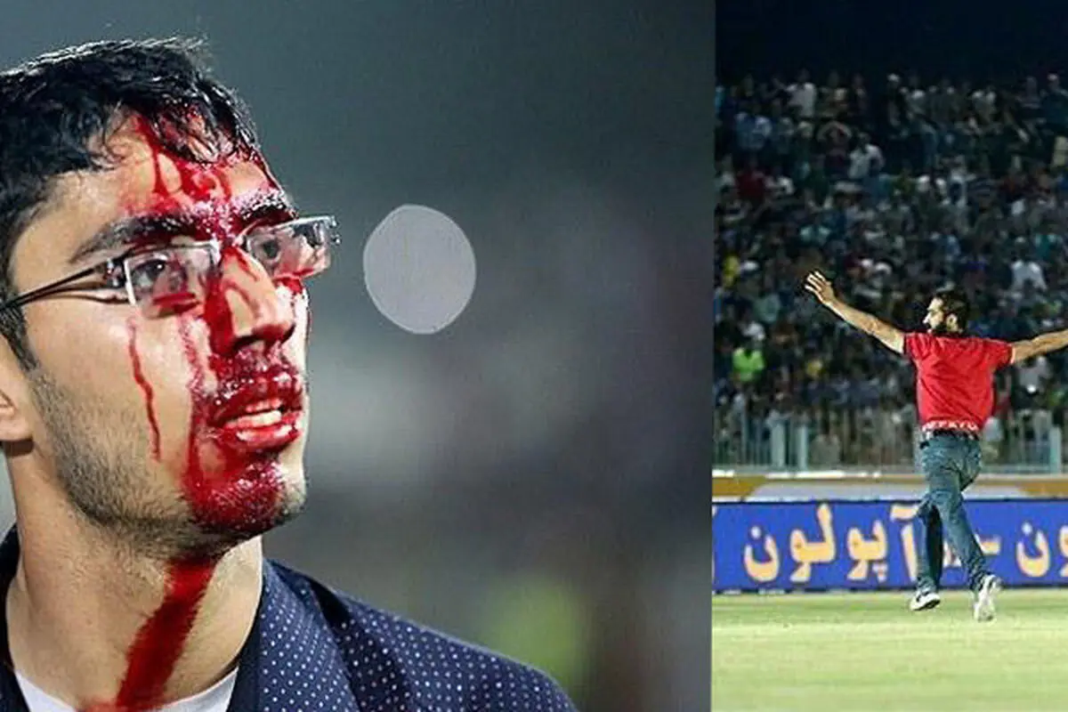 مرد محبوب پرسپولیس: صورت من هم بخیه خورد