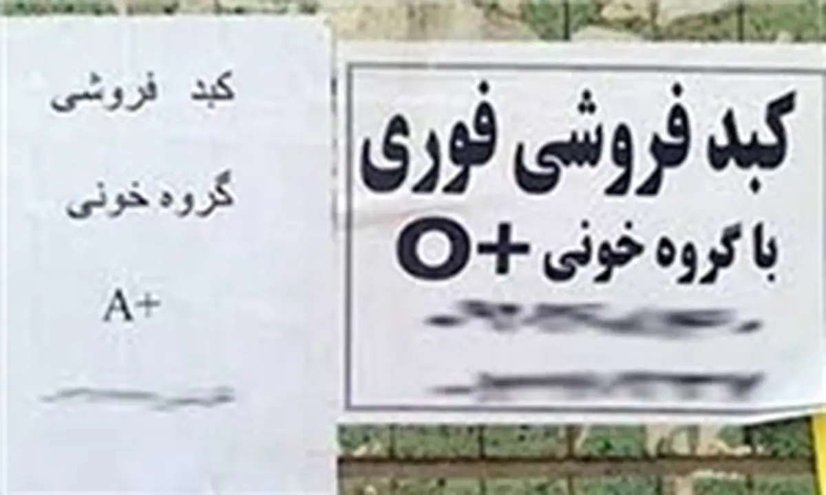 فروش کبد ۵۰۰ میلیونی در پایتخت