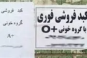 فروش کبد ۵۰۰ میلیونی در پایتخت