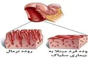 سلیاک، بیماری شایع اما ناشناخته
