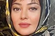 وقتی «رزیتا غفاری» دندان پزشک می شود/ عکس