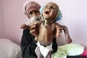 بمباران ۲۵۶ مدرسه یمن توسط عربستان