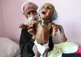 ۸۲۰ میلیون نفر در جهان از سوء تغذیه رنج می‌برند