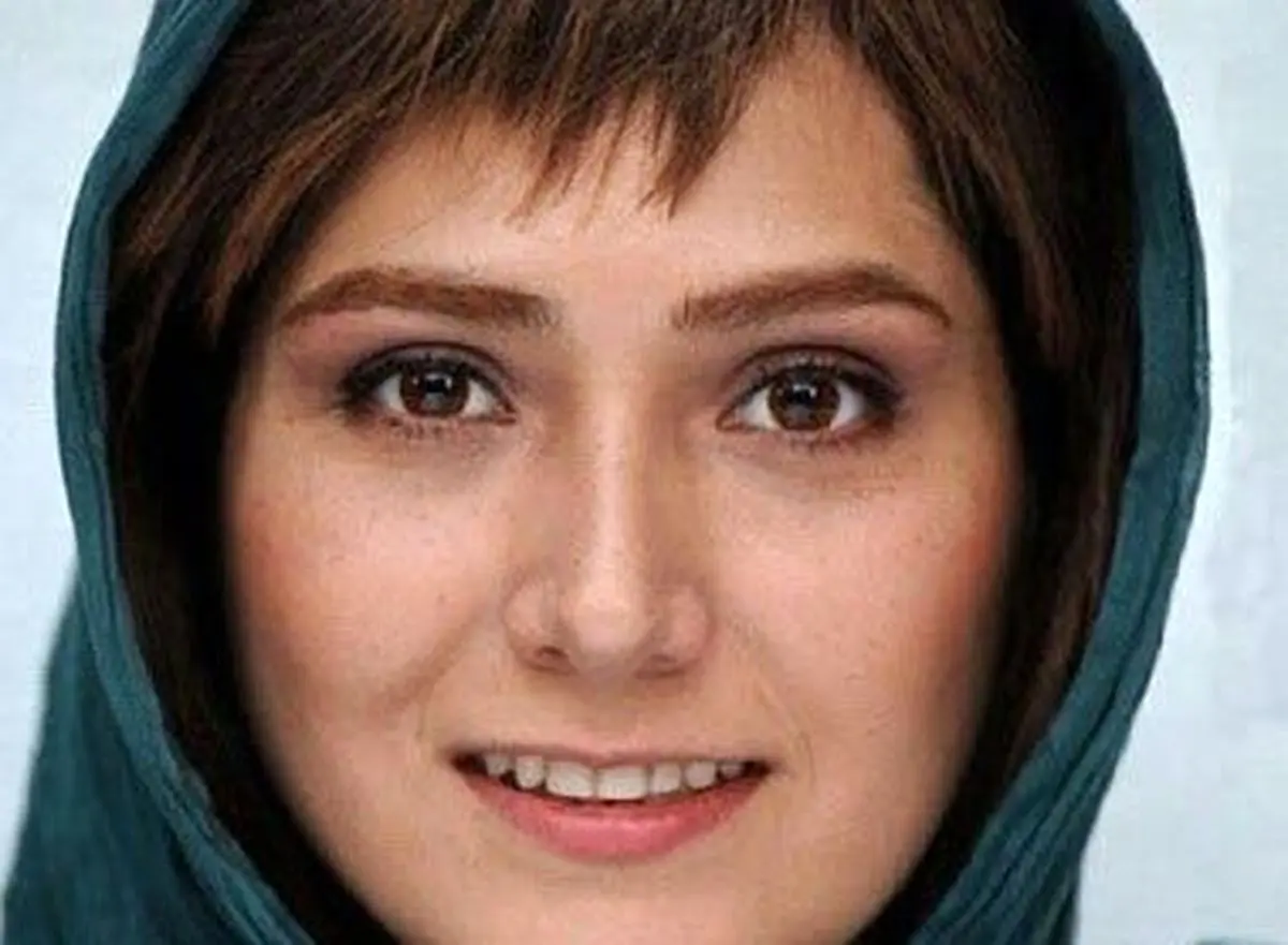 عکس خاص و عجیب "باران کوثری" بعد از تصادف
