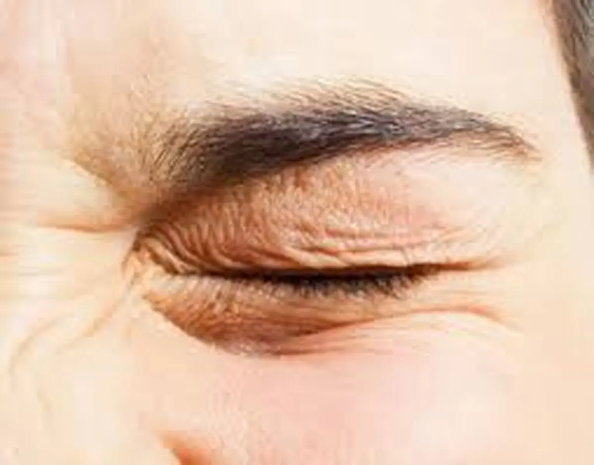 برای اصلاح عیوب انکساری چشم چه کنیم؟