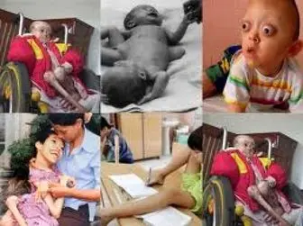 حملات شیمیایی آمریکا به کودکان بی‌دفاع + تصاویر(+ ۱۸)