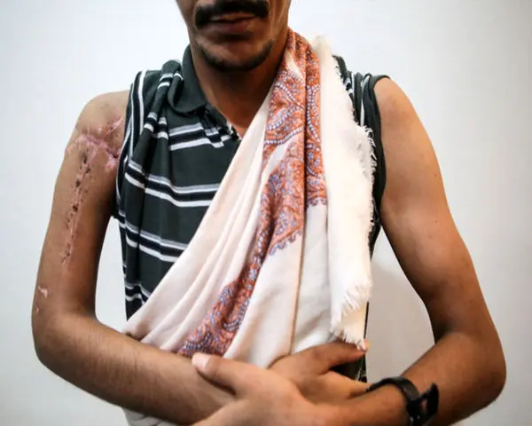 مجروحان یمنی در تهران