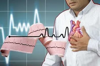 سکته قلبی چیست+علائم و اقدامات درمانی
