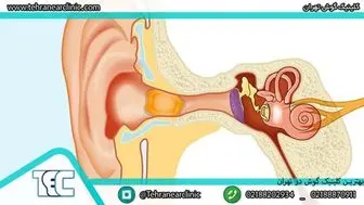 بهترین کلینیک گوش در تهران کجا است؟