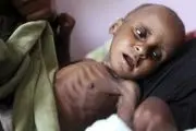 عربستان علاوه بر کشتار یمنی‌ها به آنها گرسنگی هم می‌دهد
