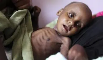 تنها شش هفته تا تمام شدن مواد غذایی در یمن 