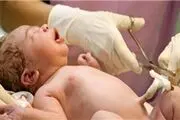 این خانواده‌ها برای ذخیره خون بندناف حتما اقدام کنند