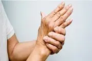 دست هایتان از سلامت شما چه می گویند