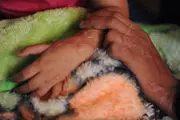 اسیدی که روزگار کودکی را سوزاند